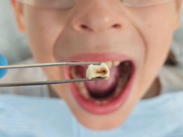 Best Tooth Pain Emergency Relief  in Jones, OK