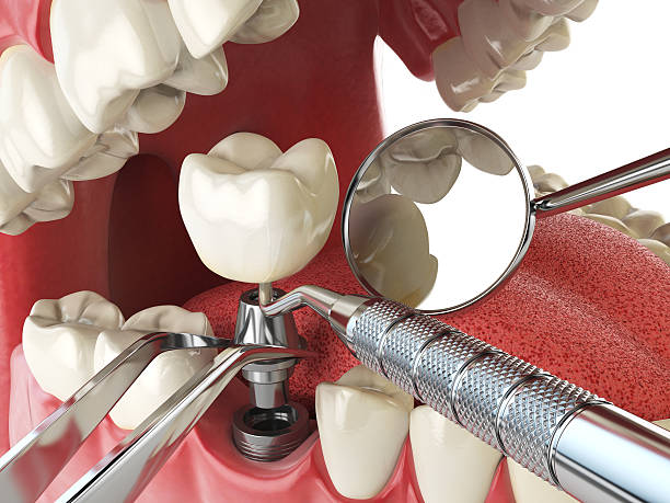 Best Emergency Gum Pain Relief  in Jones, OK